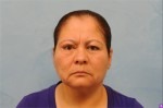 Upper Eye Lift (Blepharoplasty) Photos